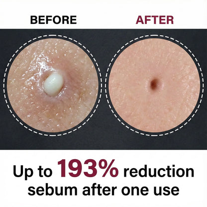 Peel Shot Glow Rice Ampoule Duo